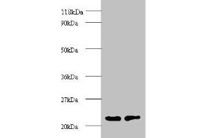 Western blot All lanes: proteasome subunit beta type-2 antibody at 2 μg/mL Lane 1: EC109 whole cell lysate Lane 2: 293T whole cell lysate Secondary Goat polyclonal to rabbit IgG at 1/15000 dilution Predicted band size: 23 kDa Observed band size: 23 kDa (PSMB2 anticorps  (AA 1-201))