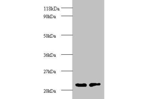 PSMB2 anticorps  (AA 1-201)
