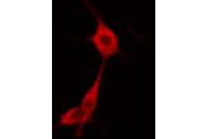 ABIN6274669 staining HuvEc cells by IF/ICC.