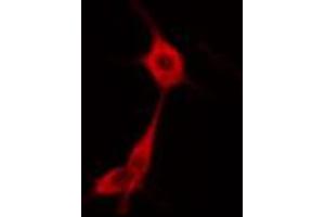 ABIN6274669 staining HuvEc cells by IF/ICC. (GBP1 anticorps  (C-Term))