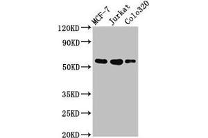 Western Blot Positive WB detected in: MCF-7 whole cell lysate, Jurkat whole cell lysate, Colo320 whole cell lysate All lanes: IRX4 antibody at 3 μg/mL Secondary Goat polyclonal to rabbit IgG at 1/50000 dilution Predicted band size: 55, 58 kDa Observed band size: 55 kDa (IRX4 anticorps  (AA 287-363))
