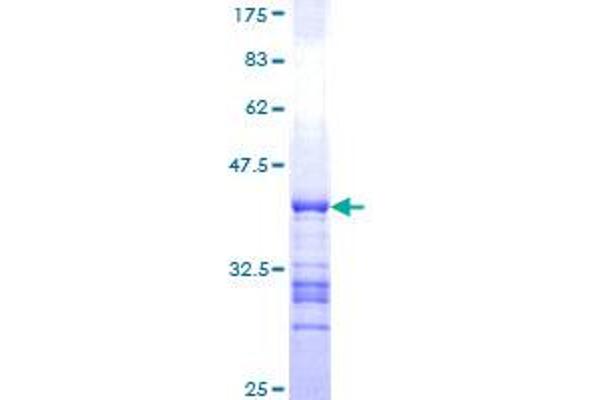 NDUFV3 Protein (AA 1-100) (GST tag)
