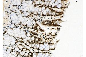 ABIN6261115 and ABIN6266521 at 1/100 staining Rat stomach tissue by IHC-P. (Cullin 2 anticorps  (C-Term))