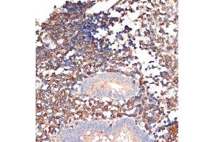 Immunohistochemistry of paraffin-embedded human appendix using EHD1 Rabbit mAb (ABIN7266911) at dilution of 1:100 (40x lens).