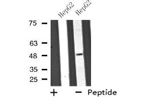 Western blot analysis of extracts from HepG2 cells using ATP6V1C2 antibody. (ATP6V1C2 anticorps  (Internal Region))