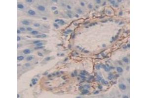 IHC-P analysis of Rat Tissue, with DAB staining. (TTR anticorps  (AA 20-147))