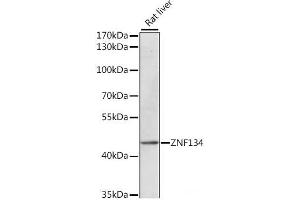 Western blot analysis of extracts of Rat liver using ZNF134 Polyclonal Antibody at dilution of 1:1000. (ZNF134 anticorps)