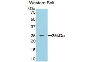 Western Blotting (WB) image for anti-Sclerostin Domain Containing 1 (SOSTDC1) (AA 24-206) antibody (ABIN1860599) (SOSTDC1 anticorps  (AA 24-206))
