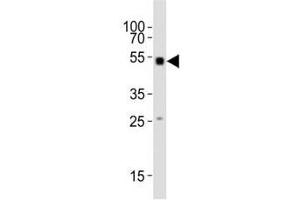 Western blot testing of Smad1 antibody at 1:1000 dilution + mouse skeletal muscle lysate