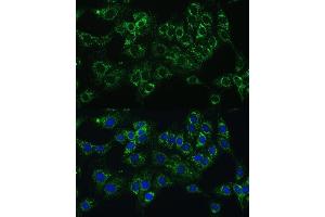 Immunofluorescence analysis of C6 cells using CYB5A Polyclonal Antibody (ABIN6130832, ABIN6139296, ABIN6139297 and ABIN6221049) at dilution of 1:100 (40x lens).