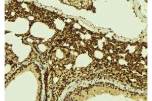 ABIN6267140 at 1/100 staining Mouse lung tissue by IHC-P. (MSK1 anticorps  (pSer360))