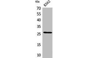 Western Blot analysis of K562 cells using FGF-8 Polyclonal Antibody. (FGF8 anticorps  (Internal Region))