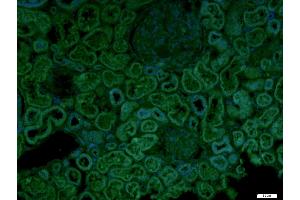 anti-Cat Eye Syndrome Chromosome Region, Candidate 1 (CECR1) (AA 450-500) antibody