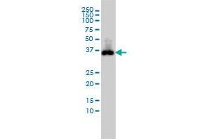 CDX2 monoclonal antibody (M01), clone 1C7 Western Blot analysis of CDX2 expression in COLO 320 HSR . (CDX2 anticorps  (AA 1-313))