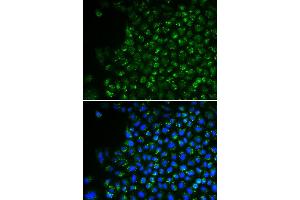 Immunofluorescence analysis of U2OS cell using PDHA1 antibody. (PDHA1 anticorps)