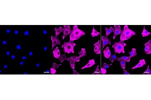 Immunocytochemical staining of C2C12 cells with Actin antibody (ABIN7797458), 1:1,000). (Recombinant Actin anticorps)