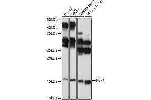 Western blot analysis of extracts of various cell lines, using RBP1 antibody (ABIN6129597, ABIN6146795, ABIN6146796 and ABIN6214136) at 1:1000 dilution. (RBP1 anticorps  (AA 63-197))