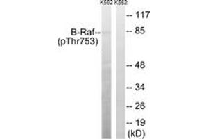 Western blot analysis of extracts from K562 cells treated with EGF 200ng/ml 30', using B-Raf (Phospho-Thr753) Antibody. (SNRPE anticorps  (pSer753))