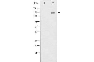 Western blot analysis of HER2 phosphorylation expression in HepG2 whole cell lysates,The lane on the left is treated with the antigen-specific peptide. (ErbB2/Her2 anticorps  (pTyr1112))