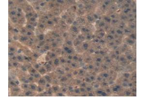 IHC-P analysis of Rat Liver Tissue, with DAB staining. (aHSP anticorps  (AA 2-102))