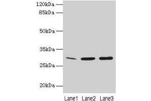 Western Blot All lanes: GTF2F2 antibody at 16 μg/mL Lane 1: Mouse spleen tissue Lane 2: K562 whole cell lysate Lane 3: A549 whole cell lysate Secondary Goat polyclonal to rabbit IgG at 1/10000 dilution Predicted band size: 29 kDa Observed band size: 29 kDa