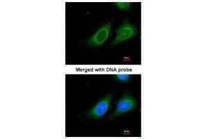 ICC/IF Image Immunofluorescence analysis of paraformaldehyde-fixed HeLa, using 15-PGDH, antibody at 1:200 dilution.