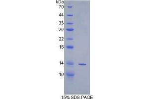 SDS-PAGE analysis of Human Spindlin 3 Protein. (SPIN3 Protéine)