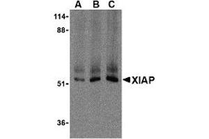 Western Blotting (WB) image for anti-X-Linked Inhibitor of Apoptosis (XIAP) (C-Term) antibody (ABIN1030806) (XIAP anticorps  (C-Term))