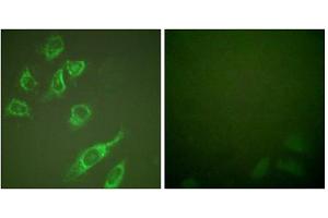 Immunofluorescence analysis of HeLa cells, treated with PMA (125ng/ml, 30mins), using 14-3-3 zeta (phospho-Ser58) antibody. (14-3-3 zeta anticorps  (pSer58))