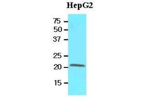 Cell lysates of HepG2 (60 ug) were resolved by SDS-PAGE, transferred to nitrocellulose membrane and probed with anti-human RBP4 (1:500). (RBP4 anticorps  (AA 19-201))