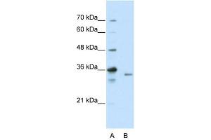WB Suggested Anti-EXOSC3 Antibody Titration:  2. (EXOSC3 anticorps  (C-Term))