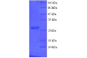 Nidogen 1 (NID1) (AA 428-665) protein (His tag)