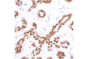 Immunohistochemistry (IHC) image for anti-SRY (Sex Determining Region Y)-Box 10 (SOX10) (AA 416-466) antibody (ABIN7454037)
