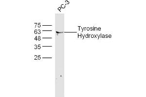 Human PC-3 lysates probed with Tyrosine Hydroxylase Polyclonal Antibody, unconjugated  at 1:300 overnight at 4°C followed by a conjugated secondary antibody at 1:10000 for 60 minutes at 37°C. (Tyrosine Hydroxylase anticorps  (AA 101-165))
