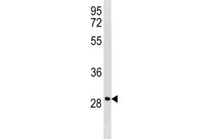 Western Blotting (WB) image for anti-Leucine Rich Repeat Containing 61 (LRRC61) antibody (ABIN3004534) (LRRC61 anticorps)