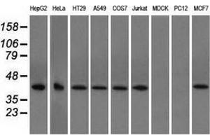 Western blot analysis of extracts (35 µg) from 9 different cell lines by using anti-ACAT2 monoclonal antibody. (ACAT2 anticorps)