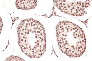 Immunohistochemistry of paraffin-embedded rat testis using DDX17 Rabbit mAb (ABIN7266688) at dilution of 1:100 (40x lens).
