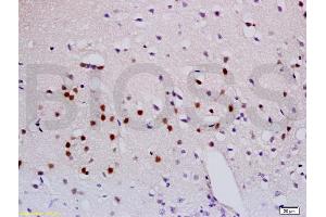 Formalin-fixed and paraffin embedded mouse brain labeled with Anti-Sema3A Polyclonal Antibody, Unconjugated (ABIN737961) at 1:200 followed by conjugation to the secondary antibody and DAB staining. (SEMA3A anticorps  (AA 22-120))