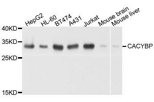 Western blot analysis of extracts of various cell lines, using CACYBP antibody. (CACYBP anticorps  (AA 1-228))