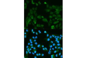 Immunofluorescence analysis of HeLa cell using PHPT1 antibody. (PHPT1 anticorps  (AA 1-125))