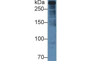 Detection of PLEC in Human U2OS cell lysate using Polyclonal Antibody to Plectin (PLEC) (PLEC anticorps  (AA 175-400))