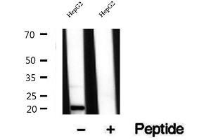 Western blot analysis of extracts of HepG2 cells, using TIM22 antibody. (TIMM22 anticorps  (Internal Region))