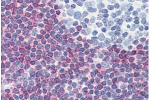 anti-Programmed Cell Death 4 (PDCD4) (AA 1-469) antibody