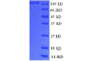 phosphorylase, Glycogen, Brain (GPBB) (AA 6-843), (partial) protein (GST tag)