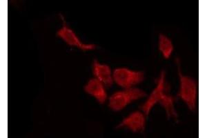 ABIN6278060 staining Hela by IF/ICC.