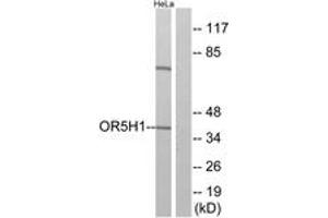Western Blotting (WB) image for anti-Olfactory Receptor, Family 5, Subfamily H, Member 1 (OR5H1) (AA 262-311) antibody (ABIN2891026) (OR5H1 anticorps  (AA 262-311))