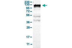 Western Blot analysis of human cell line RT-4 with KIF11 polyclonal antibody . (KIF11 anticorps  (AA 373-477))