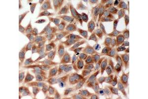 Anti-TRAF2 antibody, ICC ICC: HELA Cell