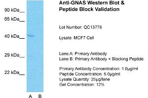 Host: Rabbit  Target Name: GNAS  Sample Tissue: MCF7 Whole Cell  Lane A:  Primary Antibody Lane B:  Primary Antibody + Blocking Peptide Primary Antibody Concentration: 1 µg/mL Peptide Concentration: 5 µg/mL Lysate Quantity: 41 µg/laneGel Concentration:. (GNAS anticorps  (N-Term))