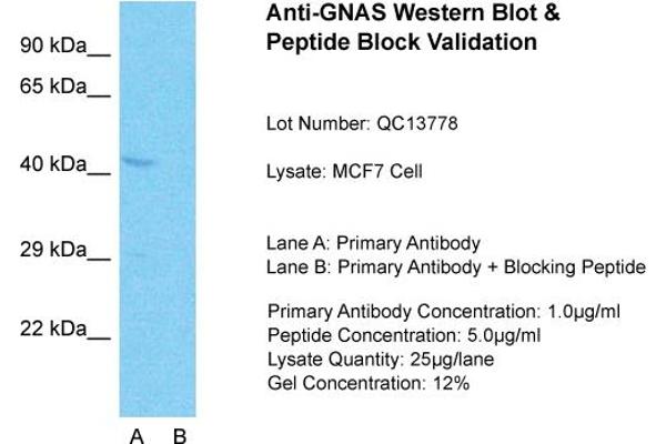 GNAS anticorps  (N-Term)